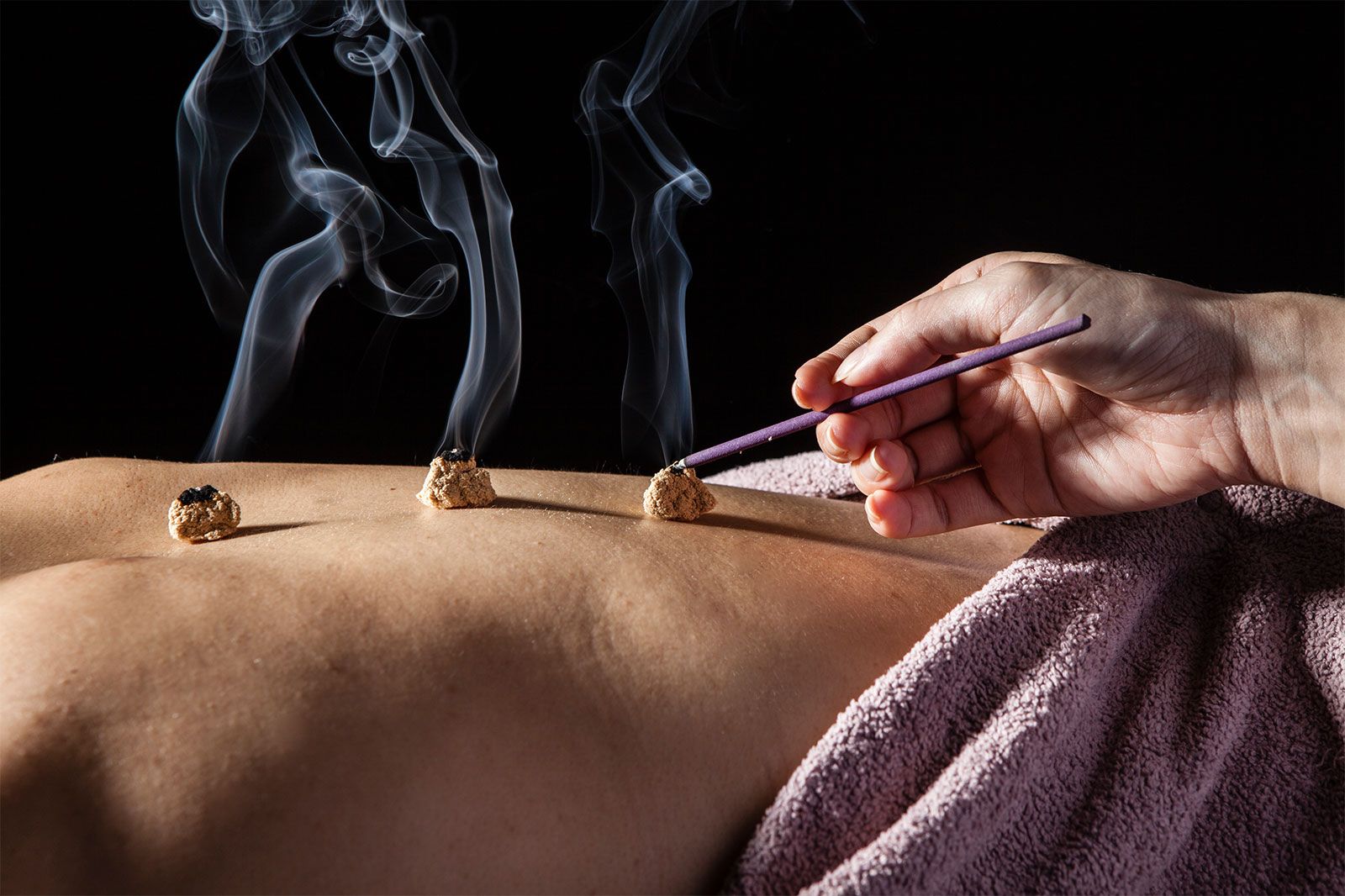 Illustration en encre chinoise évoquant la moxibustion